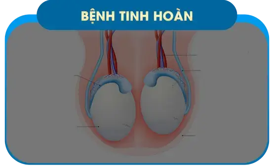 Bệnh tinh hoàn